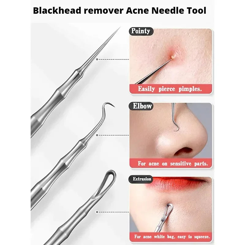 Pimple Killa' Blackhead Tweezers ✨