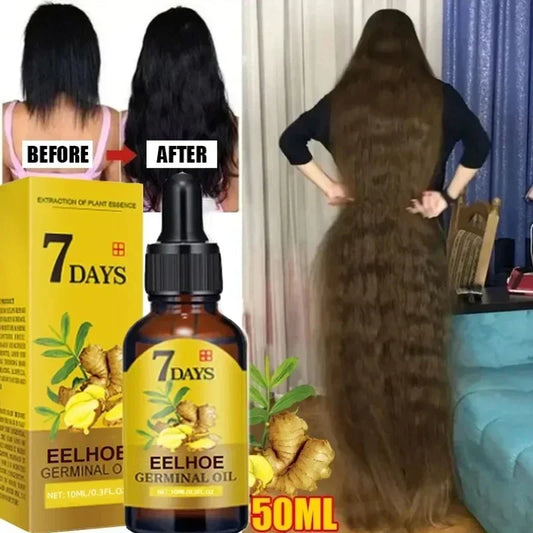 Fast Hair Growth - Oil Ginger Growth Hair Treatment ✨